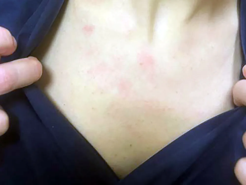 “il-ragazzo-deve-essere-visitato-e-subito”-e-giu-botte-alle-infermiere-del-servizio-118.